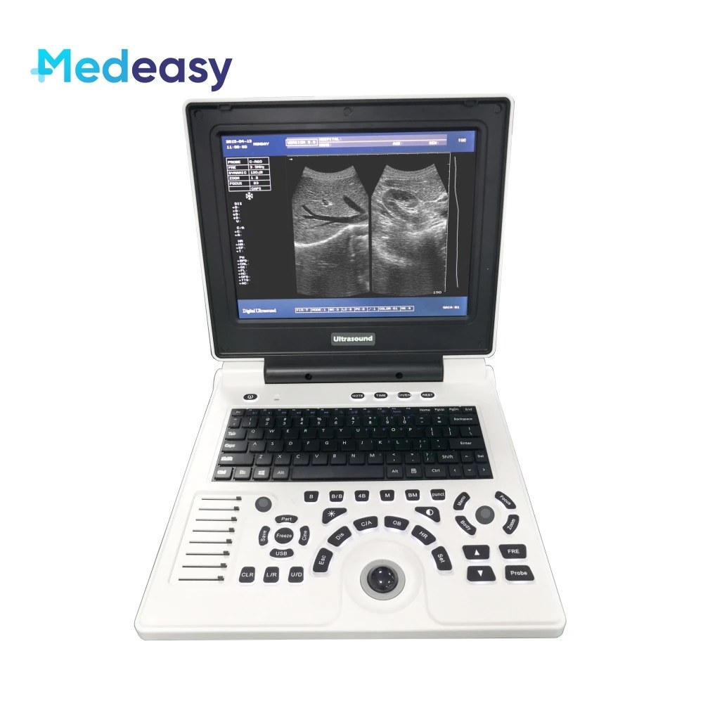 Medeasy 12" Portable Notebook B Ultrasound Scanner